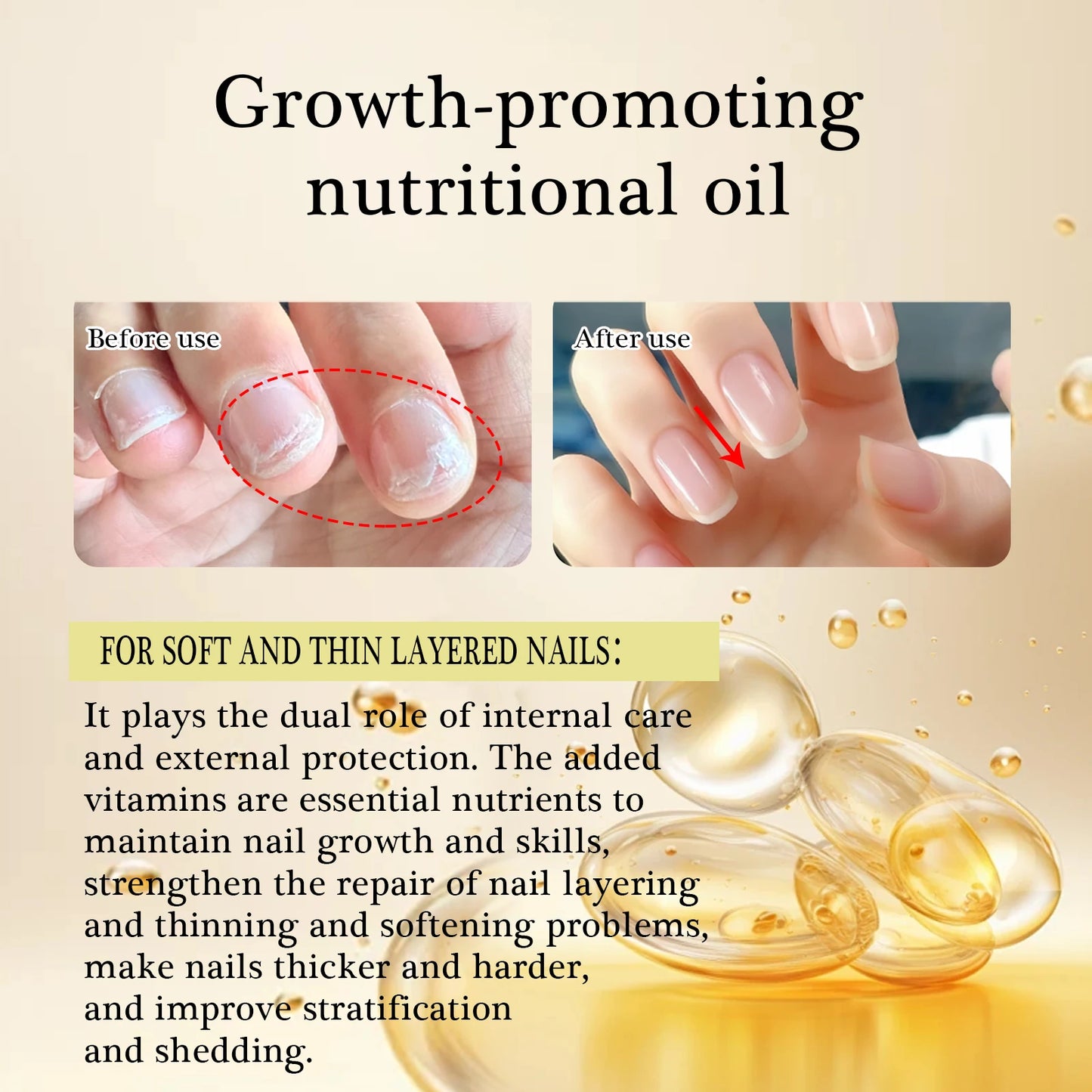 12ml Nails Growth Promoting Nutrient Oil For Repairing Soft And Thin Layered Nails, Nail layering High Quality Nail Care Oil
